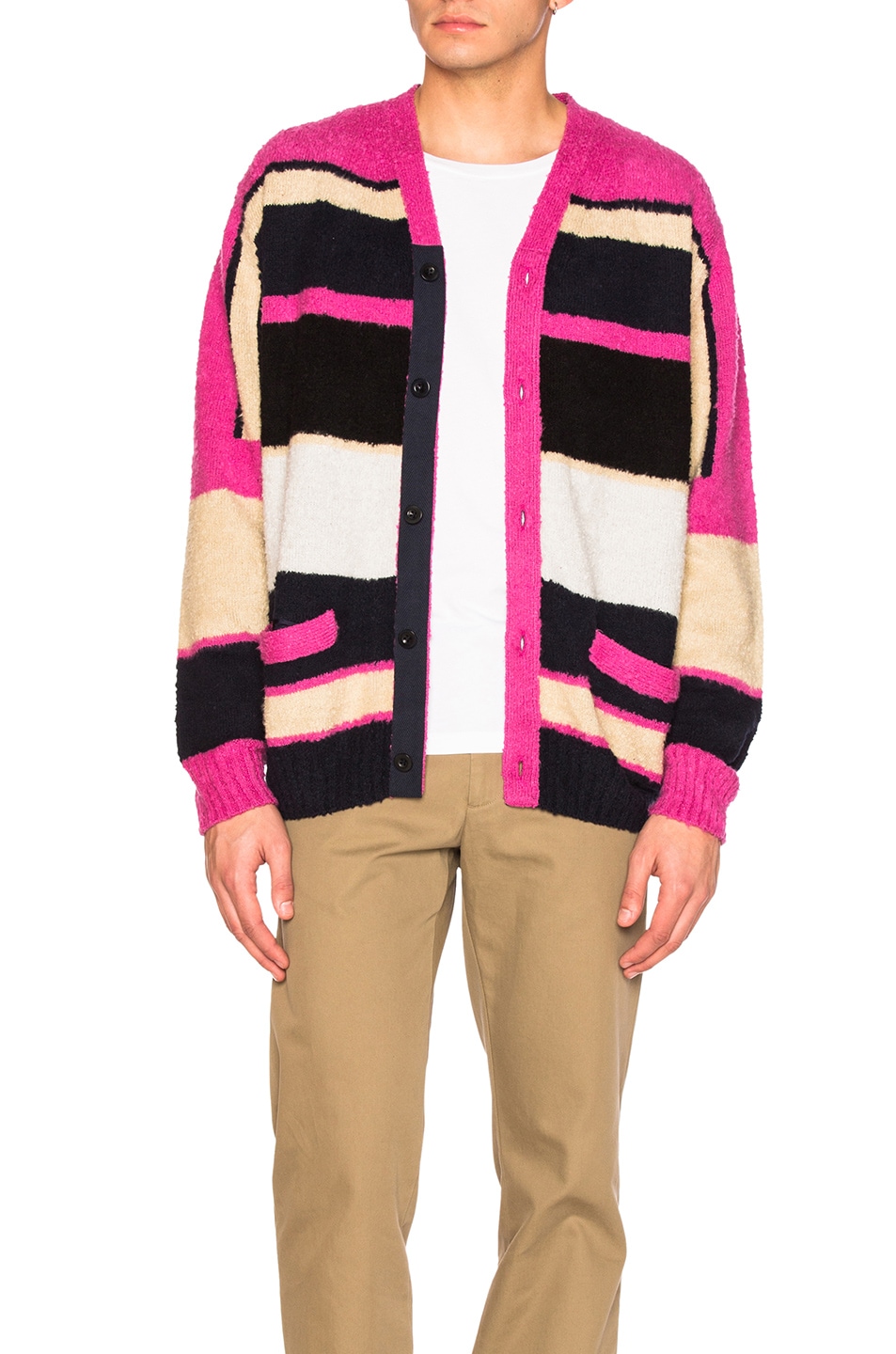 Image 1 of Sacai Stripe Knit Cardigan in Pink Multi