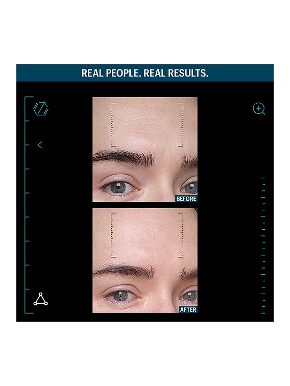 Multi Peptides & Gf Advanced Lifting Serum