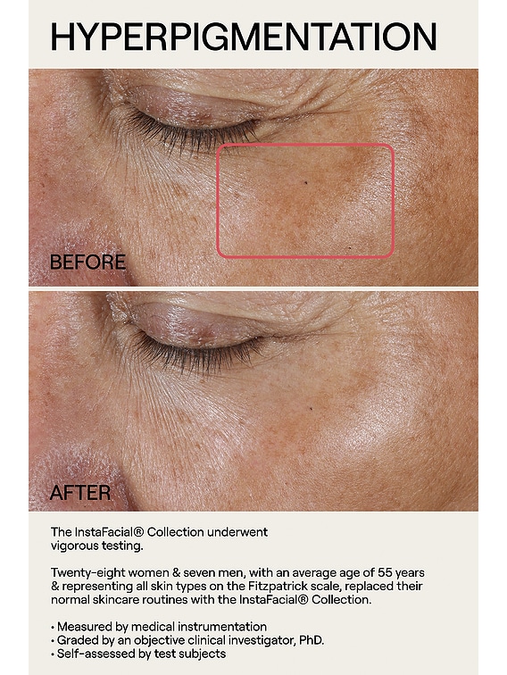 Instafacial Collection Plasma