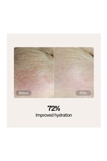 LYMA Skincare Serum &amp; Cream Starter Kit , view 4, click to view large image.